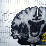 gabapentin - dangers of gabapentin - gaba detox - detox from gabapentin - drug rehab - prescription medication